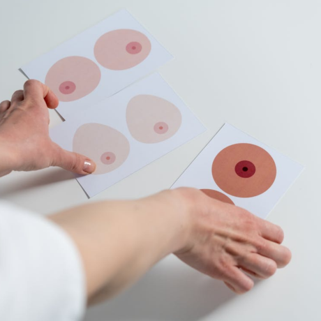 Breast Lump Evaluation